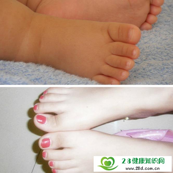 用10%的福尔马林溶液轻擦脚掌，慎勿擦破皮肤，连用数日，可治脚臭。